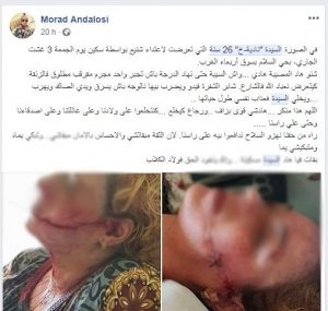 اضغط على الصورة لرؤيتها بالحجم الطبيعي