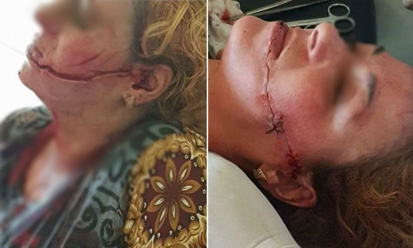 اضغط على الصورة لرؤيتها بالحجم الطبيعي