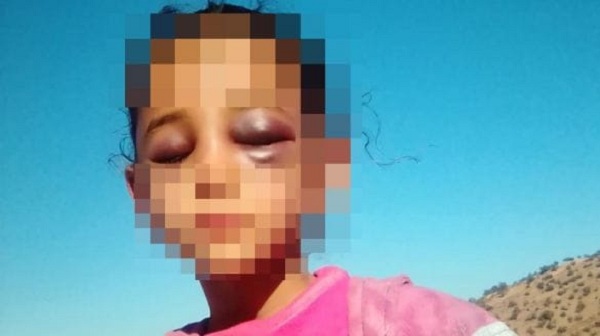 اضغط على الصورة لرؤيتها بالحجم الطبيعي