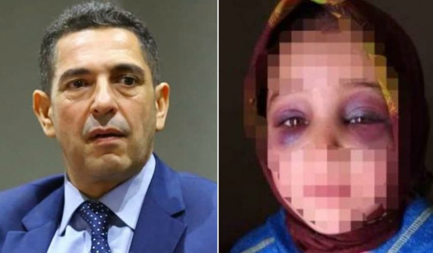 ط§ط¶ط؛ط· ط¹ظ„ظ‰ ط§ظ„طµظˆط±ط© ظ„ط±ط¤ظٹطھظ‡ط§ ط¨ط§ظ„طط¬ظ… ط§ظ„ط·ط¨ظٹط¹ظٹ